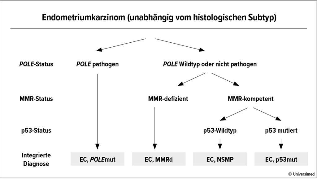 Den Molekularen Code Des Endometriumkarzinoms Entziffern Onkologie Universimed Medizin Im 